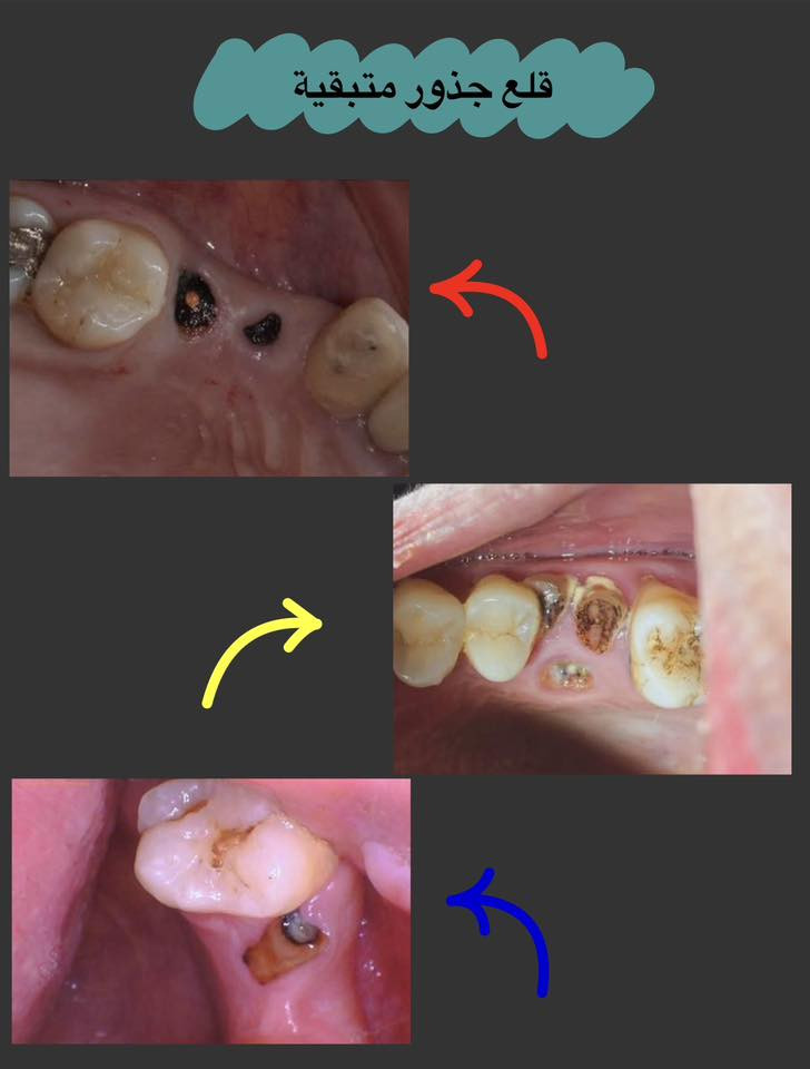 📍عيادات ابن سينا التخصصية-مقابل محطة وقود البياع
📝للحجز والاستفسار:
.مراسلة الصفحة
.واتساب ***********
✨علماً ان العلاج مجاني بالكامل
