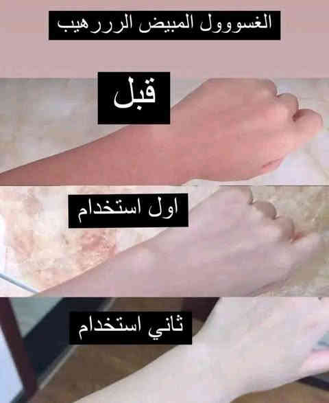 شرطنة الوحيدتجربتك هية التهمنة جرب قبل الاستلام 
بشرط بشرط بشرط نتائئج من اول دقيقة فوري  بنفس الحضة يبين فرق سارع واحجز هسة شنو منتظرة رجالي نسائي كل جسم 

غسول التببييض السححري يسعمل لكافة الجسسم والووجه والمناطقق الححسساسه  

مكوناته طين بركاني طبيعي لتبي يض وتنتعيم الببشره ومع الاستمرار 
سارع واحجز رسالينا او اتصل 
***********
