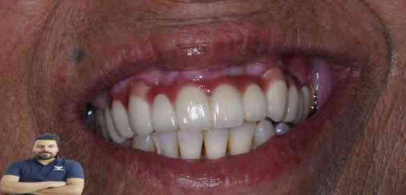 المراجعة جانت مسوية تركيب بغير عيادة فترة وواكع
لان الاسنان كلش تعبانة رجعنة بنينة الاسنان وسوينالهة تركيب سيراميك

العنوان / المسيب / شارع البلدية / مقابل دكتور جعفر وفي للاطفال

للحجز والاستفسار
***********
***********
