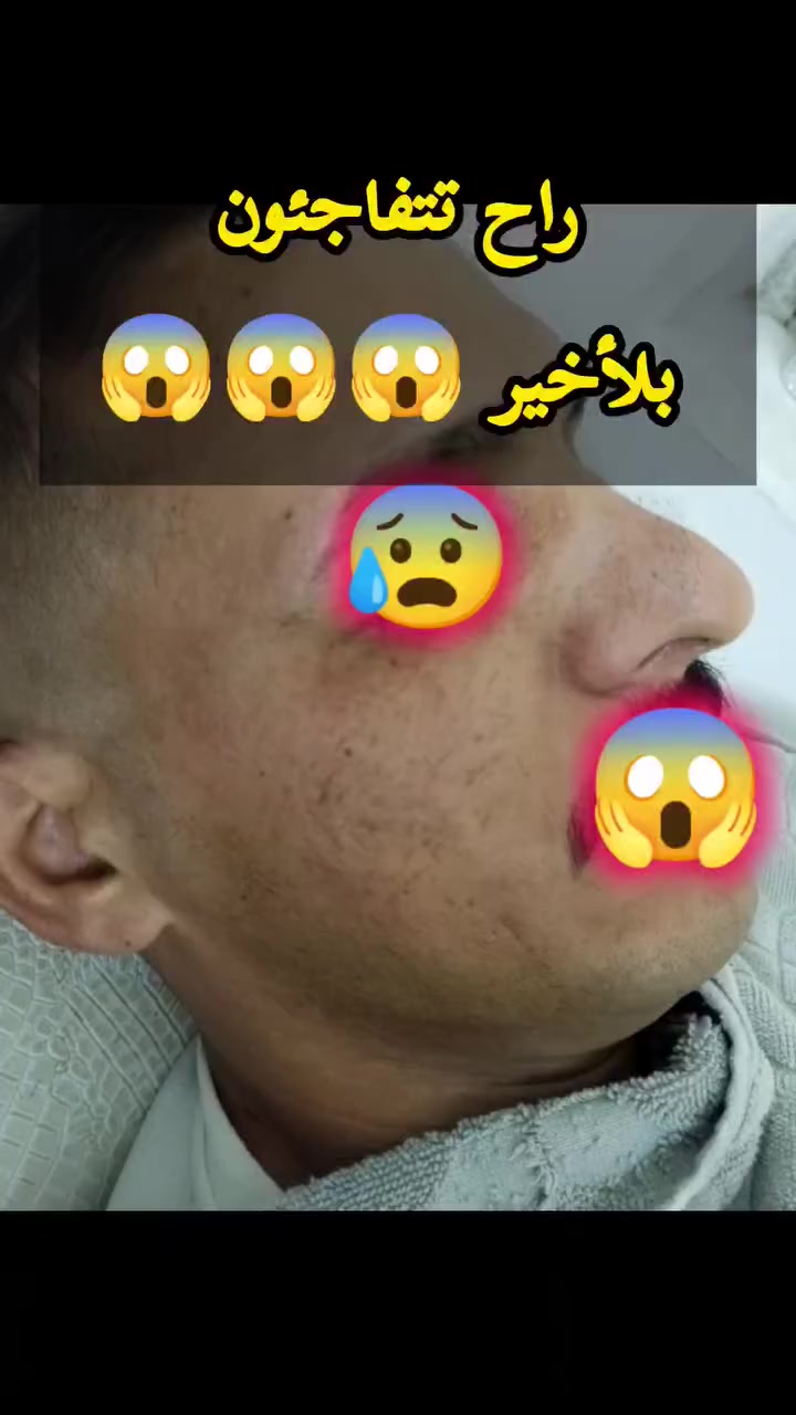 هذا الماسك مع الحلاقه دوه لبشرتك 🤩
للحجز مراسلة الصفحه
واتساب ***********
واتساب ***********
