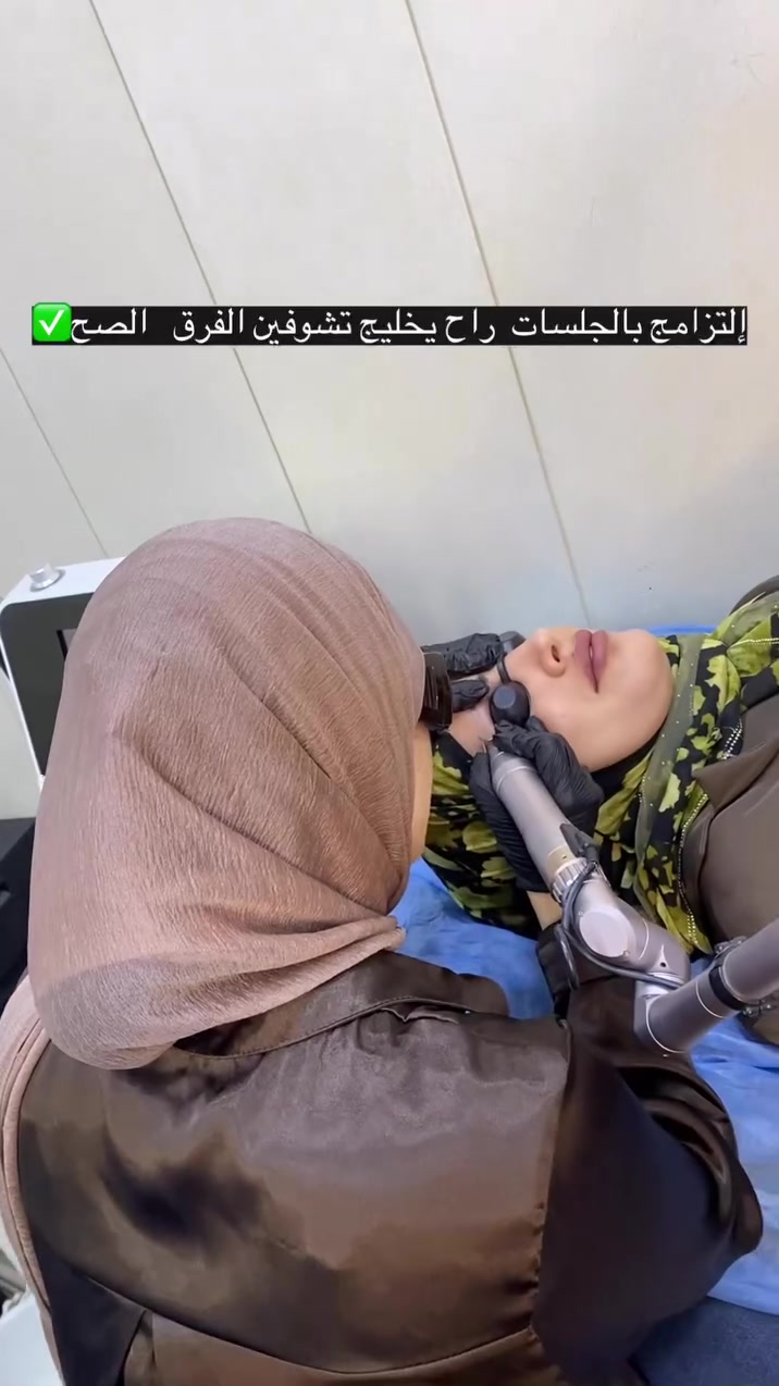 ازالة التاتو بجهاز البيكوتك العالمي بعيادتنا😍🔥

زورونا بعيادة الدكتورة سناء عبد علي 
العنوان:شارع الاسكان مجاور الحرمين
☎️:***********
