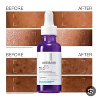 سيروم Mela B3 • نياسيناميد ١٠٪ • علاج التصبغات