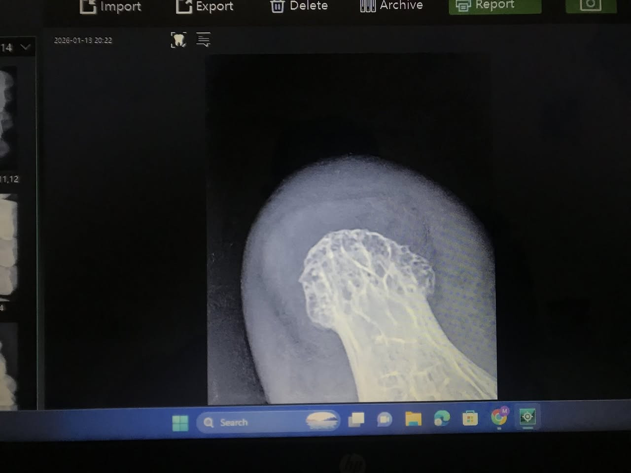 جهاز بورتبل + سنسر اشعه ، جديد فتح على كد التجربه فقط ، السعر خاص


**إذا كنت صاحب هذا الإعلان وتريد حذفه لأي سبب، رجاءا أرسل رسالة إلى الدعم الفني**