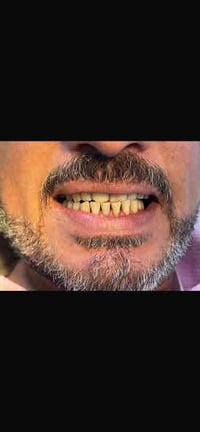 الى الاهالي الكرام ♥️  نود اعلامكم عن افتتاح عيادة طب وجراحة الاسنان د...
