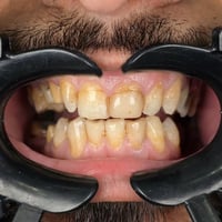 عيادة اسنان • تبييض اسنان • زراعة اسنان