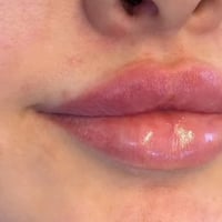 رسمات • فلر • عروض