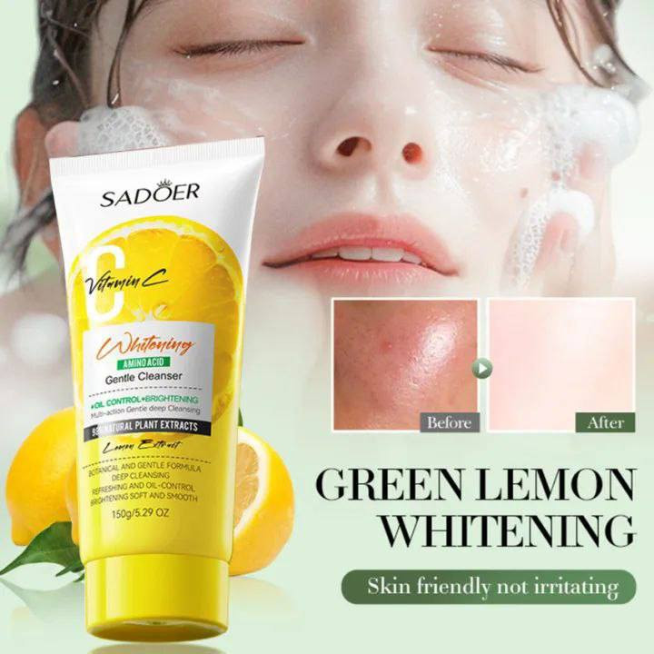 للــبيع بـ جملة وباسعار تنافسية 
نتعامل بـ نضام الكراتين والدرازن 

https://t.me/alwafra9


**إذا كنت صاحب هذا الإعلان وتريد حذفه لأي سبب، رجاءا أرسل رسالة إلى الدعم الفني**