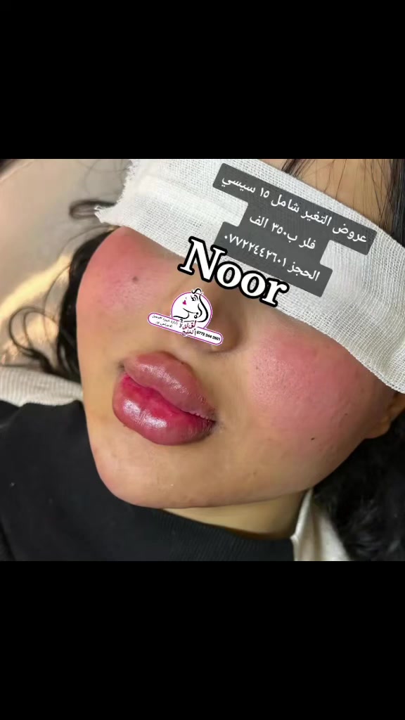 عروض الفلر الكوري التغير شامل ١٠سيسي سيسي فلر ب ٢٥٠ الف
١٥فلر سيسي ٣٥٠ الف 
فلر كوري سيسي شفه ٥٠ الف 
فلرشفه سويسري سيسي ٧٥ الف 
العنوان بغداد الامين الثانية سكينه
 الحجز ***********
