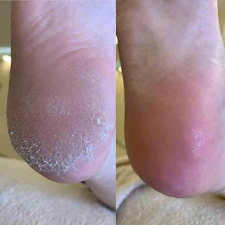 صالون فيروزة يرحب بكم 
باديكير اليد والقدم 20الف 
للتواصل ***********عنوان الشالجية مضرب الدبات
