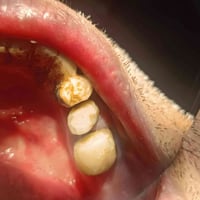 حي البساتين قرب مرطبات كريم سفيح الدكتور حاتم مالك فوك المظمد السيد جا...