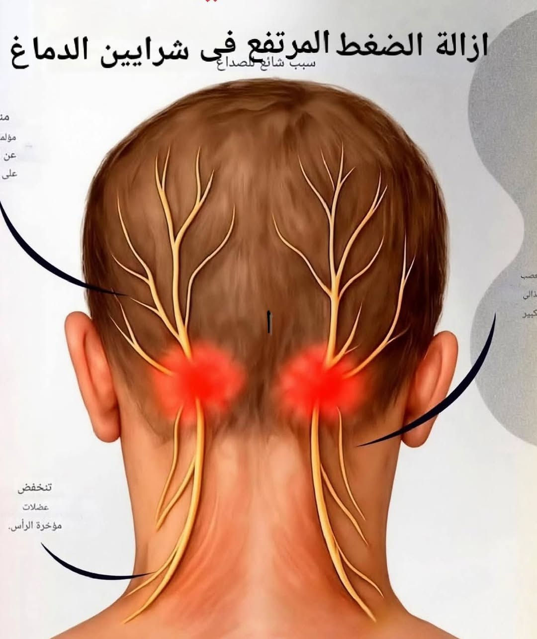 💠 حجامة الرحمة – السماوة 💠
📍 حي الجمهوري / خلف جامع حي الجنهوري /مجاور مكتب حمدي للحاسبات
✨ نقدم لكم العلاج بالحجامة وفق أصول علمية وخبرة متميزة ✨
🔹 أبرز الحالات التي تساعد الحجامة في تحسينها:
✔️ آلام الرقبة والكتف والظهر
✔️ الصداع المزمن والشقيقة
✔️ تنشيط الدورة الدموية
✔️ الإرهاق والتعب العام
✔️ آلام المفاصل والروماتيزم
✔️ القلق والتوتر واضطرابات النوم
✔️ بعض حالات ارتفاع الضغط والسكر (بإشراف طبي)
✔️ تنقية الجسم من السموم
🌿 الحجامة وسيلة طبيعية وآمنة تساعد الجسم على استعادة نشاطه وتوازنه
📞 للحجز والاستفسار:
***********
🔸 صحتكم أمانة… ونحن هنا لخدمتكم 🔸
