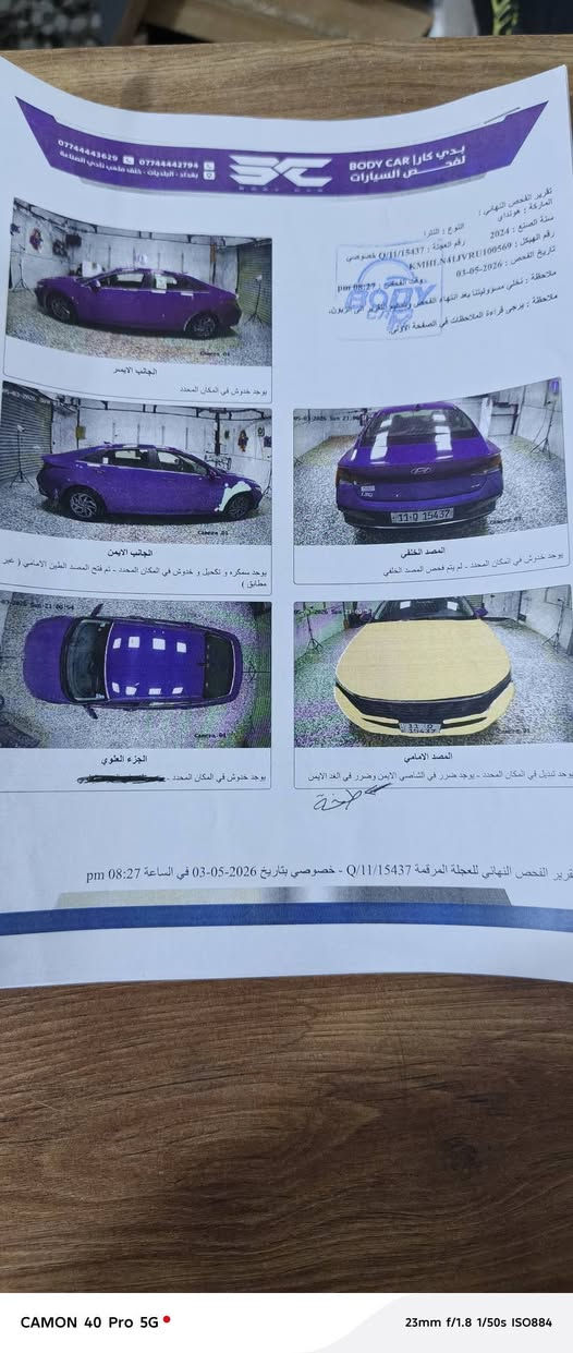 للبيع: هيونداي النترا 2024 (هايبرد)
​الموديل: 2024.
​اللون: أزرق مميز.
​المصدر: وارد كوري.
​الحالة العامة: السيارة بنظافة عالية جداً، محرك وكير وفول مواصفات الهايبرد المعروفة بالهدوء والاقتصادية.
​تفاصيل الحادث:
​البنيد: تبديل 
​الجاملغ: تصليح 
​بقية السيارة  سليمة وشرط الفحص.
​المواصفات:
​محرك هايبرد (اقتصادي جداً بقطرة البنزين).
​شاشة لمس كبيرة تدعم Apple CarPlay و Android Auto.
​كاميرا دوارة وحساسات خلفية وأمامية.
​نظام رادار وتحديد مسار.
​إنارة LED نهارية وتصميم داخلي حديث.
​الموقع: بغداد - حي الشعب.
للتواصل والاستفسار: ***********
السعر 137
