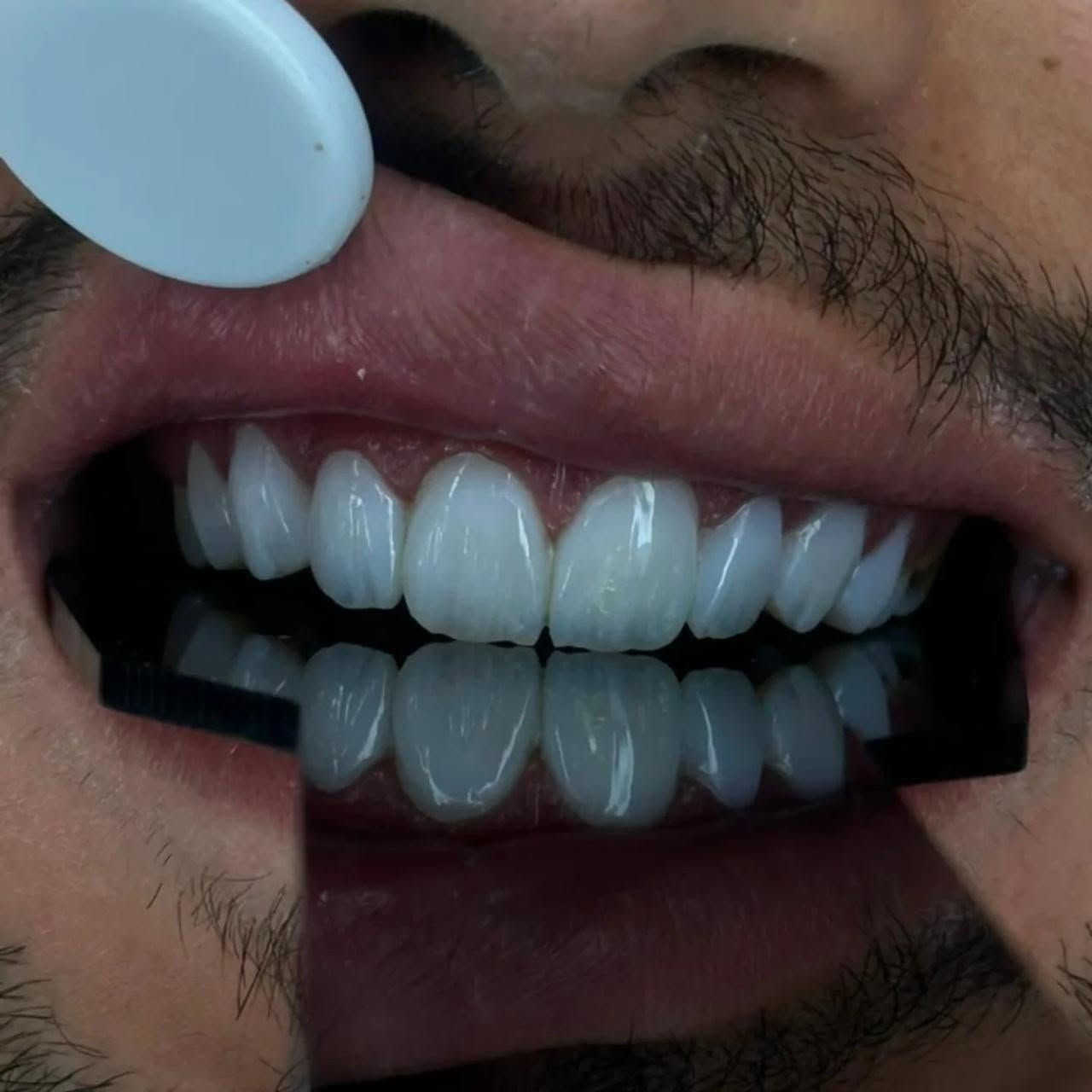 "الابتسامة المثالية حلم كل إنسان، اكتشف جمال ابتسامتك بخدماتنا."

متواجدين لخدمتكم طيلة أيام الأسبوع #الشركة_الطبية_العالمية 

🔻
🏢 العنوان / بغداد _ بسماية _ الشارع العام  . مجاور ماركت الغدير 
فوق مطعم بي تاون
📲 للحجز والاستفسار 
***********
#مركز_بسماية_لطب_وتجميل_الاسنان
