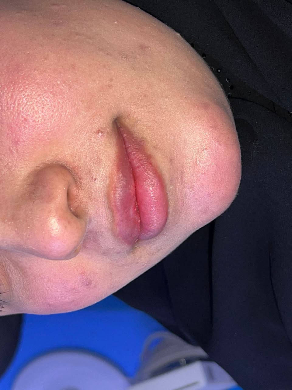 عروضنه الحلوه
فلر ديلوكس ب 50 الف
فلر براند لكوري ب 75
4 سيسي فلر 240
6 سيسي فلر 360
8 سيسي فلر480
10 سيسي فلر600


**إذا كنت صاحب هذا الإعلان وتريد حذفه لأي سبب، رجاءا أرسل رسالة إلى الدعم الفني**