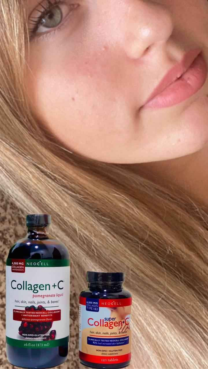 🎀عرض خاص🎀 عرض الكولاجين الامريكي🇺🇸💯 
للبشرة والجسم والشعر والاضافر والعضام والغضاريف ويقلل تجاعيد وينطي نضارة يتكون من شراب الكولاجين + حبوب الكولاجين 

1♦️حبوب سوبر كولاجين  
نوع 1 و 3 + فيتامين سي 🔥من NEOCELL الامريكيه 🇺🇸🇺🇸 تعويض نقص الكولاجين الناتج عن التقدم بالسن في البشره والشعر والبشرة والأظافر والمفاصل والعظام
♦️ زيادة ترطيب الجلد 92% عبر الدراسات الاكلينيكيه 
غير معدل وراثيا + خالية من الغلوتين
♦️مكمل غذائي
♦️التمتع بالمفاصل الصحية
♦️يعطي اشعاع ونضارة الجلد
♦️ضمان عظام صحية
♦️تقويه وتغذيه العظام والشعر 
♦️ الفيتامين سي يرفع مناعه الجسم 

2♦️كولاجين شراب الرمان مع فيتامين C
من افضل المنتجات في تقليل تساقط الشعر واعطاء نضارة للبشرة وتقوية الأظافر وهو من اكثر المكملا مبيعاً في امريكا والعالم♦️
♦️فوائد مشروب الكولاجين :
يشد البشرة ويعطيها نضارة ومظهر شبابي مبهر • 
مقوي للمفاصل والعظام
يعطي الجلد والشفتين مظهر الامتلاء ويقلل من عمق الثنايا والتجاعيد 
يقلل من خطوط وتشققات الأقدام والهالات السوداء حول العينين
منشأ العرض امريكي 🇺🇸💯 
سعر الخاص كركوك, العراق


**إذا كنت صاحب هذا الإعلان وتريد حذفه لأي سبب، رجاءا أرسل رسالة إلى الدعم الفني**