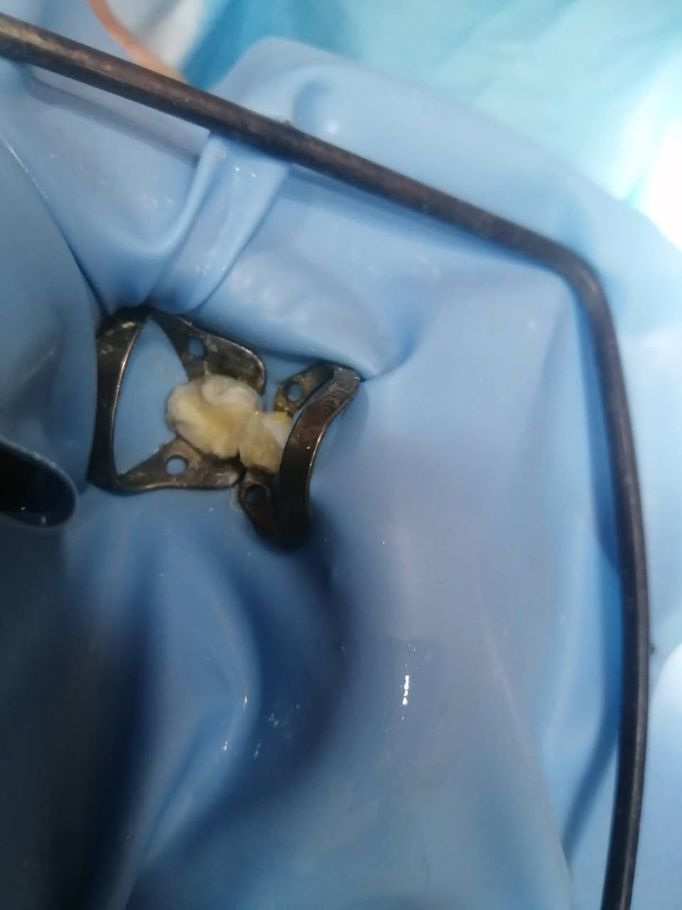 د مهند عبد الجواد الطحان الهاشمي.. ماجستير ودبلوم عالي تعويض الأسنان.. سايدين مستشفى #القياره العام.. مجاور صيدليه عبدالله المعماري. طابق ارضى. ***********#
