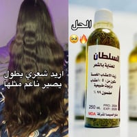 زيت بنت السلطان • مشاكل الشعر