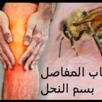 العلاج بالنحل • عرق النسا • الشطرة