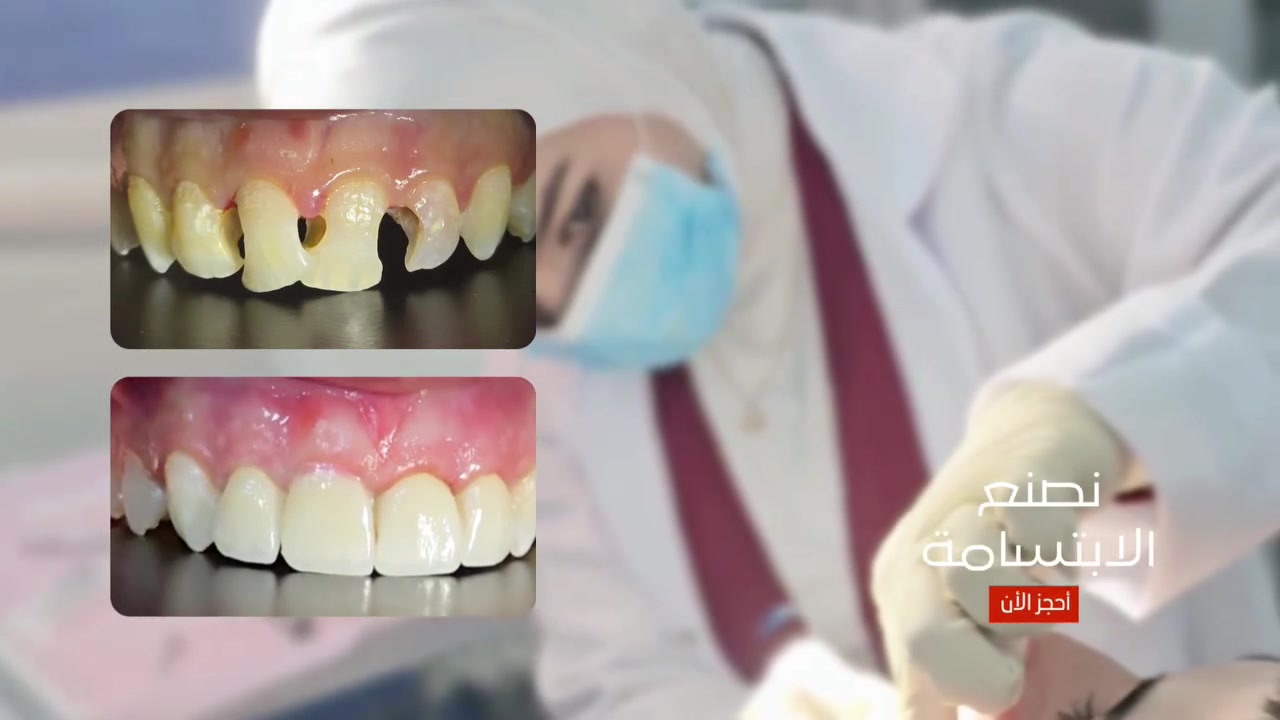 أحجز الان ***********
