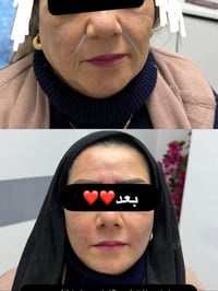 خيوط شد البشره👍🏻للتواصل 07755597827