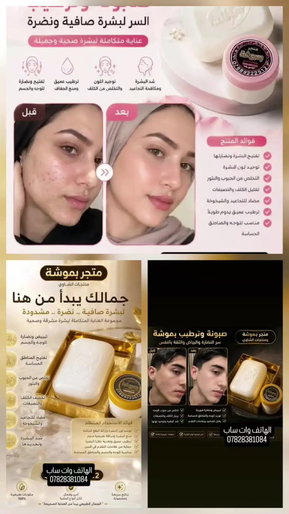 منتج كوري اصلي ضمان استرجاع
خلطه وجه +صابونه بسعر ١٥الف ويا توصيل للاستفسار خاص 
الاتصال على رقم هاتف وات ساب ***********
