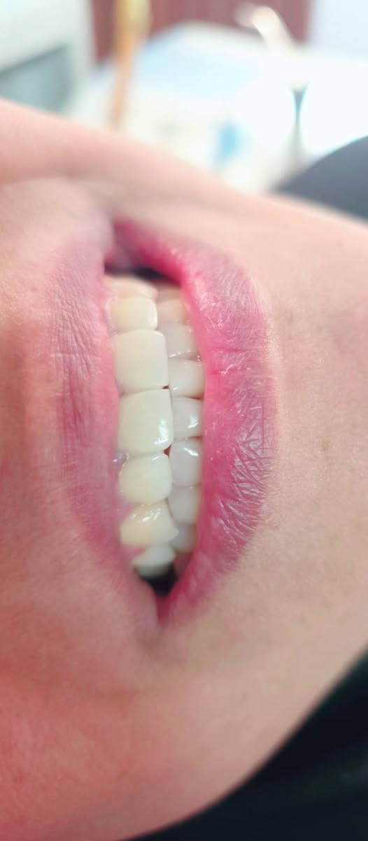 ابتسامتك هي أول انطباع… خليها دايمًا مشرقة ✨🦷  
بعيادتنا نهتم بأدق التفاصيل حتى نمنحك ابتسامة صحية وواثقة 🤍  
حجزك اليوم هو أول خطوة لابتسامة أجمل ❤️

👨‍⚕️الدكتور سيف رعد خبره في تركيبات الاسنان الثابته
وحشوات الجذور واعاده تأهيل الاسنان🦷🦷

📍 راحة • أمان • نتائج مبهرة 

📍للحجز مراسلة الصفحة او على الواتساب :
***********

📍العنوان :
• الحريه الدولعي داخل سوق الدولعي ثاني فرع ع اليمين
@إشارة
