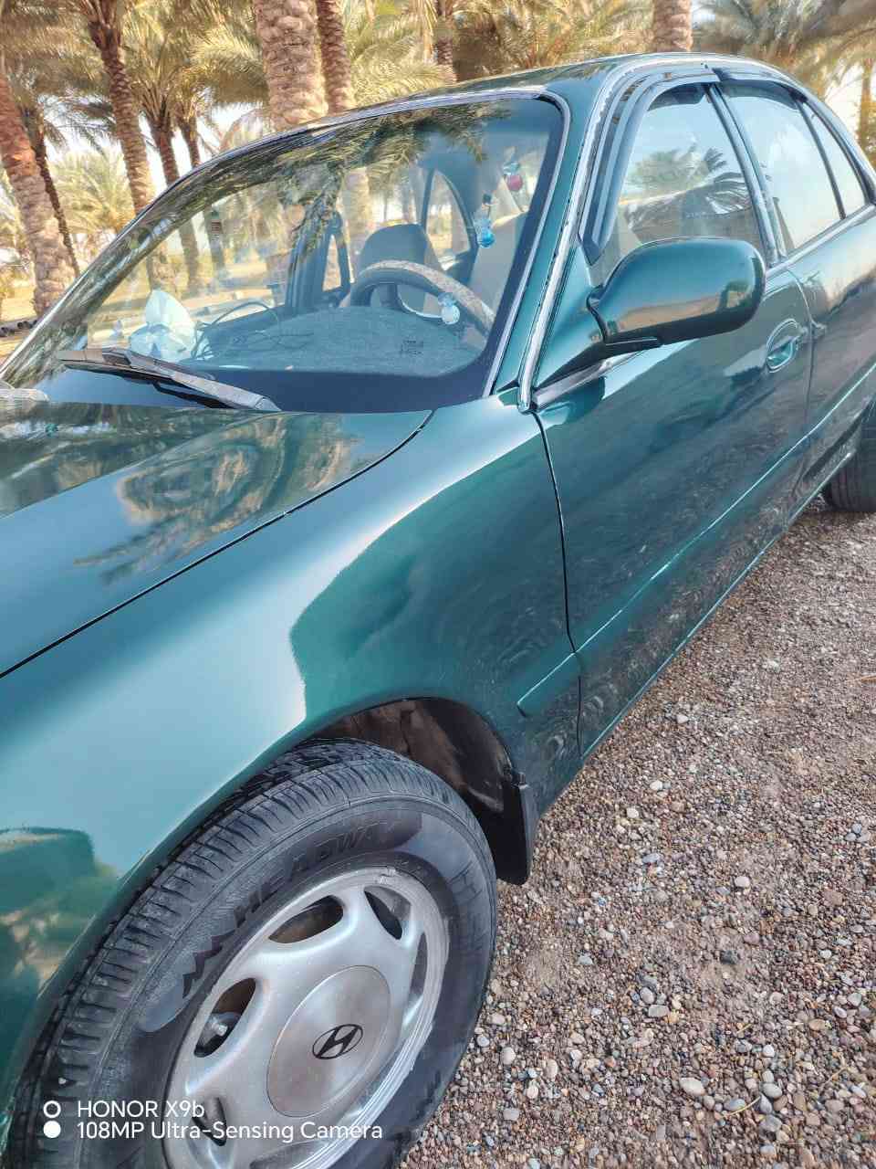 سوناتا ٢ موديل ٩٤
رقم ديالى دولي سنوية ٢٩

صبغ عام جديد بدون ضربة فقط جاردة

محرك جديد حاوية كير مضبوط جديد

جامة أمامية جديد باتري جديد

الاتصال على الرقم *********** واتساب موجود

السعر ٤٥ وبيها مجال
العنوان ديالى الخالص
