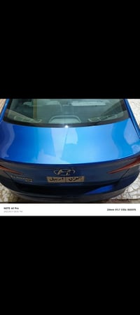 النترا • ٢٠١٧ • حادثة كربلاء