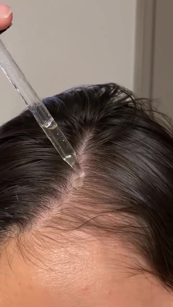 زيت إكليل الجبل (الروزماري) السحري لإنبات الفراغات، وتكثيف الشعر، وتوقيف التساقط من الجذور 🌱✨بنات منو منكم تعاني من فراغات بمقدمة الرأس؟ أو منو جربته وطلعلها بيبي هير؟ شاركونا تجاربكم بالتعليقات وسووا شير للفيديو 😍👇#عناية_بالشعر #زيت_إكليل_الجبل #الروزماري #تساقط_الشعر #إنبات_الشعر #عراقيات #بغداد #اكسبلور #ريلز_فيس_بوك"


**إذا كنت صاحب هذا الإعلان وتريد حذفه لأي سبب، رجاءا أرسل رسالة إلى الدعم الفني**