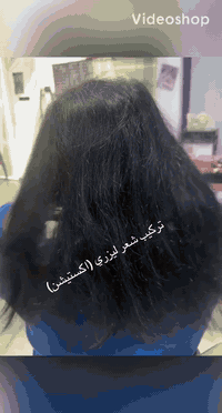 خصل ليزري • اكستيشن • قطاع30 شارع المدارس