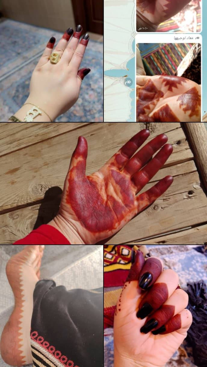 جبتلكم حنه للعيد جنن اصليه مضمونه شرط موزينه ترجع لأستفسار خاص


**إذا كنت صاحب هذا الإعلان وتريد حذفه لأي سبب، رجاءا أرسل رسالة إلى الدعم الفني**