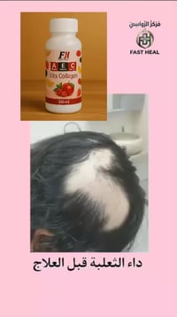 ڤيتا كولاجين • ثعلبة • مركز الرواسي