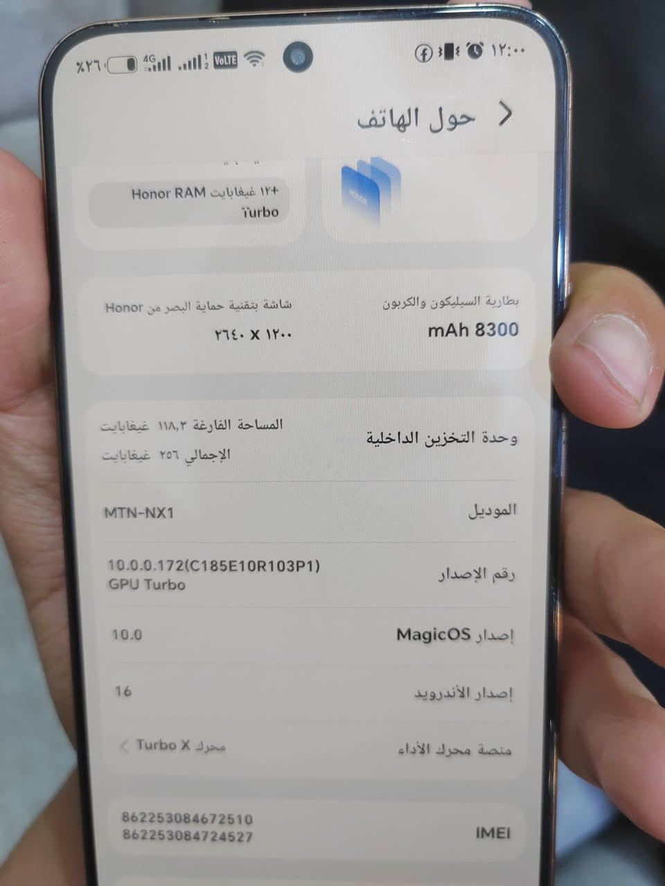 هونر x9d
#ذاكرة 256 
#رام 12
مستخدم 3تشهر

مكفول من الصيانة أو العطل 

السعر 390 قفل

الشراي خاص


**إذا كنت صاحب هذا الإعلان وتريد حذفه لأي سبب، رجاءا أرسل رسالة إلى الدعم الفني**