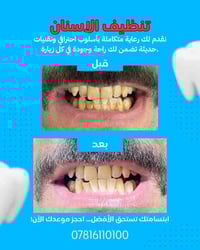 تنظيف اسنان • ازالة تصبغات • قضاء النصر