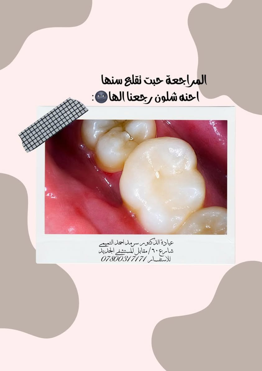 مراجعينا الكرام يتواجد الدكتور سرمد احمد التميمي في العيادة اليوم
للحجز خاص أو واتساب ***********
شارع ٦٠/ مقابل المستشفى الجديد
