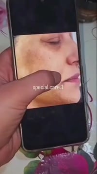 بكج رباعي • نضارة • شد التجاعيد