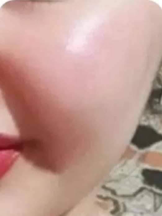 ✨كريم طبيعي✨ بياض ونضاره وتصفيه للوجه خلال اسبوع
خالي من المواد الضاره الكورتيزون والديرمويدين
يعالج الكلف والتصبغات و حب الشباب واثار الحبوب والهالات السوده ويوحد لون البشره 
عنوانه ضمانه بغداد مدينة الصدر حميديه مقابيل عماره الخضر مجمع اللطبي مركز أيلول للتجميل للحجز والاستفسار مراسلة الصفحه ا


**إذا كنت صاحب هذا الإعلان وتريد حذفه لأي سبب، رجاءا أرسل رسالة إلى الدعم الفني**