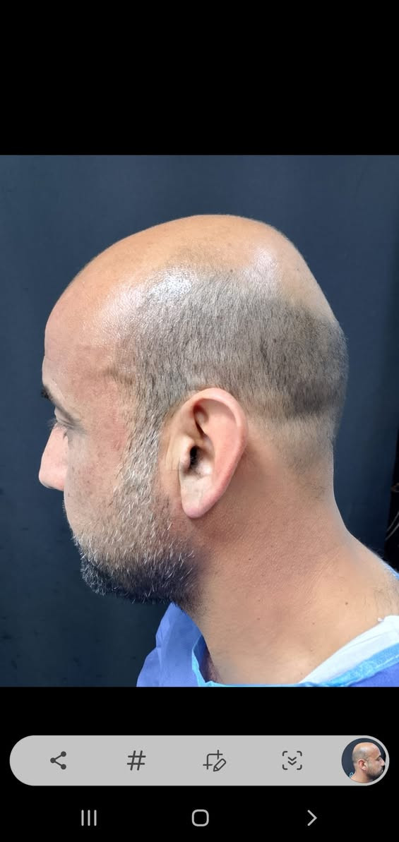 لاتتردد حاول تخطي الخطوه الاولى 
والباقي علينه 
#😄 فقط 750الف راح تغير شكلك وحياتك 
للاستفسار والحجز 🤙🙋‍♂️
***********
