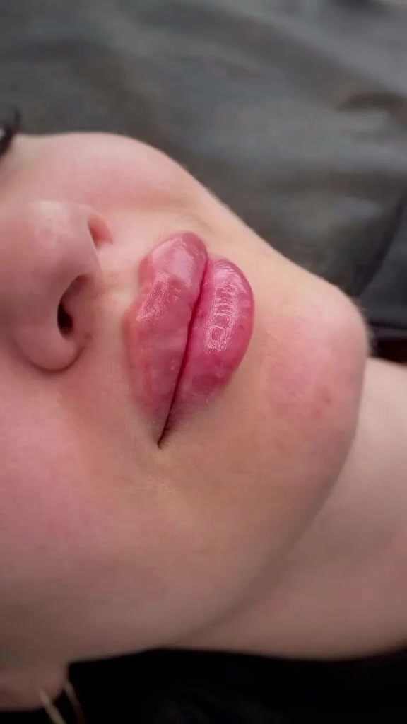 💋 شفايف ممتلئة، مرطبة ومرسومة بكل أناقة!

فيلر الشفايف يمنحك حجم طبيعي وتناسق أجمل مع ملامح وجهك، مع ترطيب ولمعة صحية تزيد من جاذبيتك. ✨

نتائج فورية ولمسة جمال تدوم. 🌸

للحجز والاستفسار مرحباً بكم على الخاص. 💌


**إذا كنت صاحب هذا الإعلان وتريد حذفه لأي سبب، رجاءا أرسل رسالة إلى الدعم الفني**