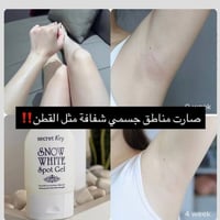 سنو وايت • تفتيح • نعومة
