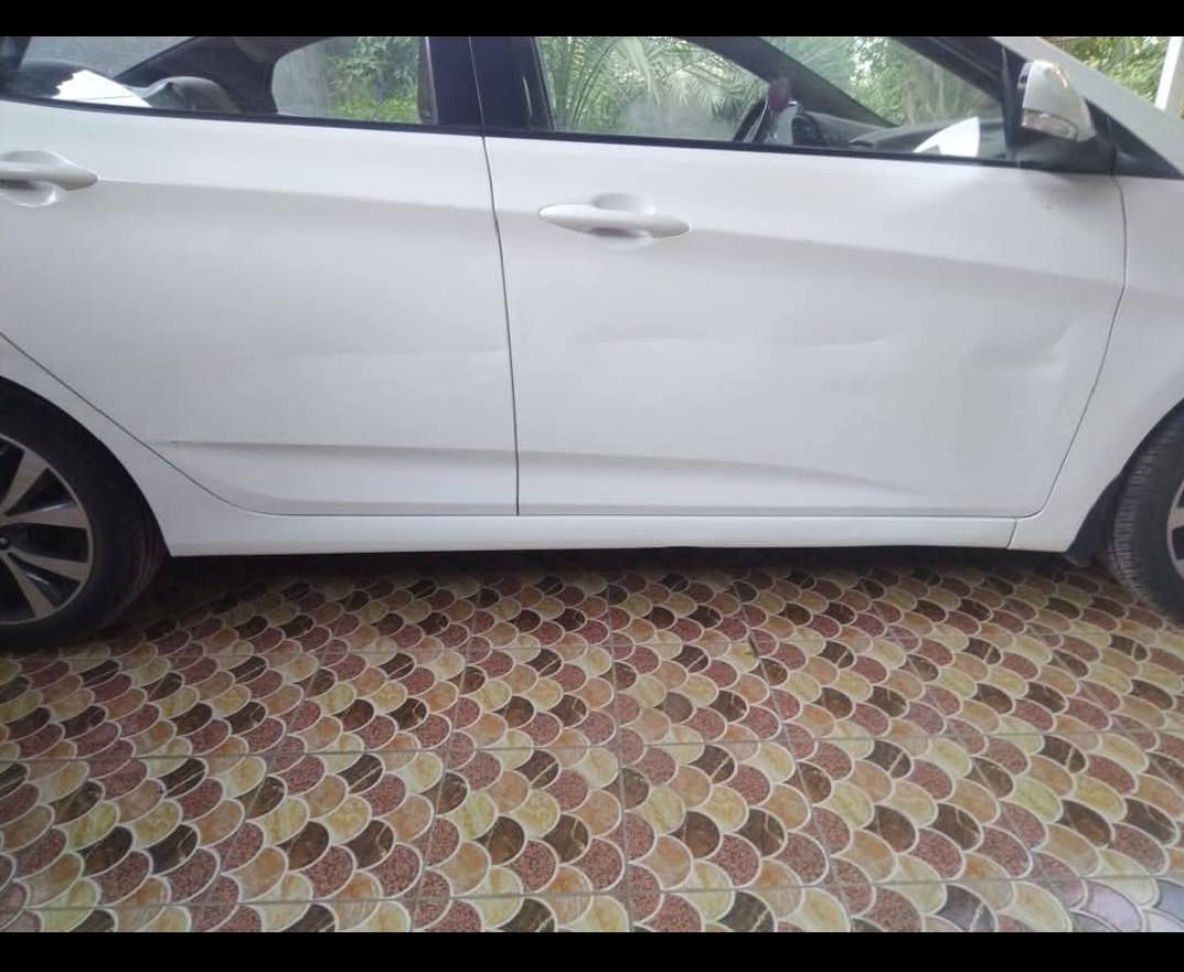 السلام عليكم
اكسنت 2016 السياره جديده 
ماشيه 84 الف كيلو متر حقيقي 
محرك كير صدر كله وضع الشركه 
المواصفات فول 1/1 فتحه سلايت اشاير بل مري 
داخل بيجي ويل حجم 16 تخم تاير جديد محرك 1600 
رقم بابل السياره مكفوله كفاله عامه ماعدا الضرر في الصوره من جهة الصدر يرجع بارد مكان السياره بابل السياحي 
خاص مغلق 
الاستفسار ***********
