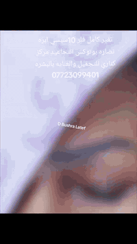 مركز كناري • فلر وبوتوكس • ازالة الوشم