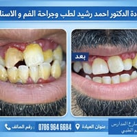 عيادة د. احمد رشيد • جراحة الفم والأسنان • اليوسفية