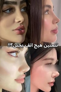 سيروم تصغير الانف • تقويم الانف • توصيل العراق