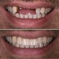 مراجعين مجانا • حشوات تجميلية • كربلاء شارع الحر