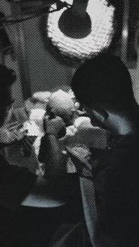 شنو يميز زراعة الشعر عدنه؟ ✅ ✔️ تصميم خط جبهة طبيعي متناسق ويّا ملامح ...