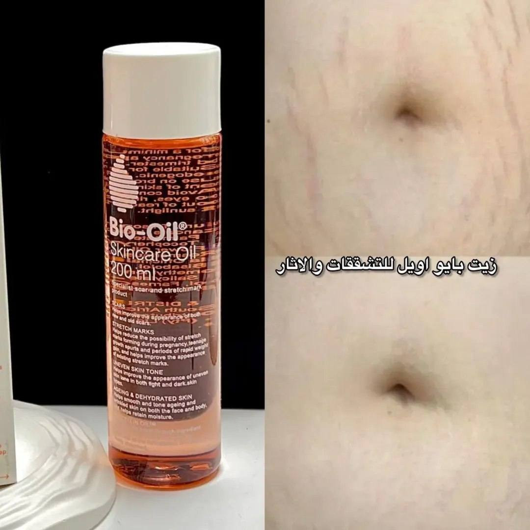 كل ماهو جديد تجدونه لدينا 
دللي نفسج وانسي كلشي وياي راح اسويج گيمر

للحجز والاستفسار خاص ☺️☺️


**إذا كنت صاحب هذا الإعلان وتريد حذفه لأي سبب، رجاءا أرسل رسالة إلى الدعم الفني**