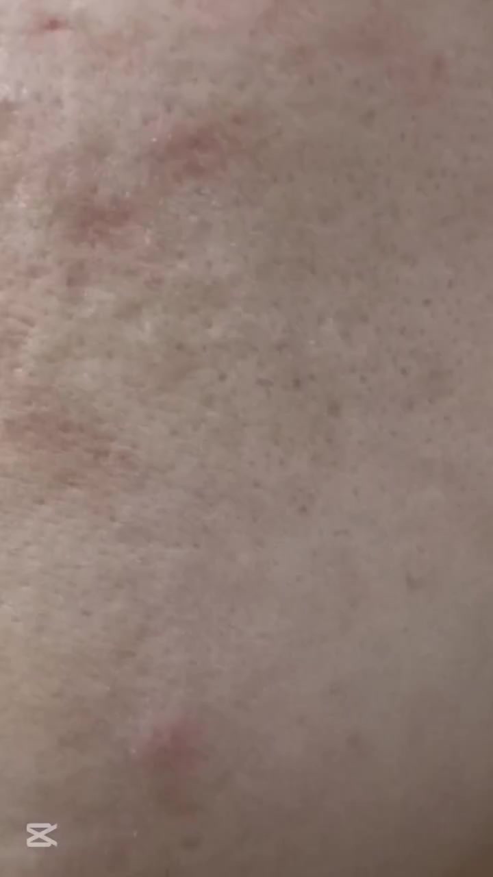 نتيجة تنظيف البشرة+استخدام المنتجات المناسبة للبشرة 
ايمان الحيالي 
للاستفسار اكثر الاتصال على الرقم 
‏‪***********‬‏
@إشارة
