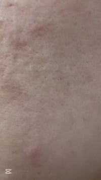 نتيجة تنظيف البشرة+استخدام المنتجات المناسبة للبشرة  ايمان الحيالي  لل...