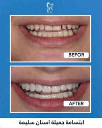 عناية بالأسنان • ابتسامة جميلة • البصرة الزبير